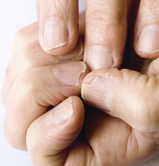 Sfat URGO - cum devin unghiile fragile